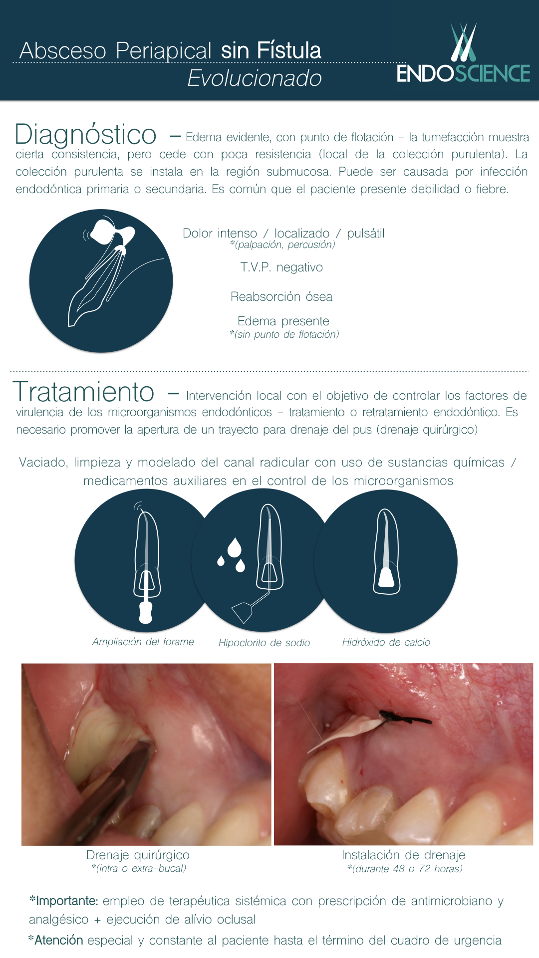 fístula de absceso periapical