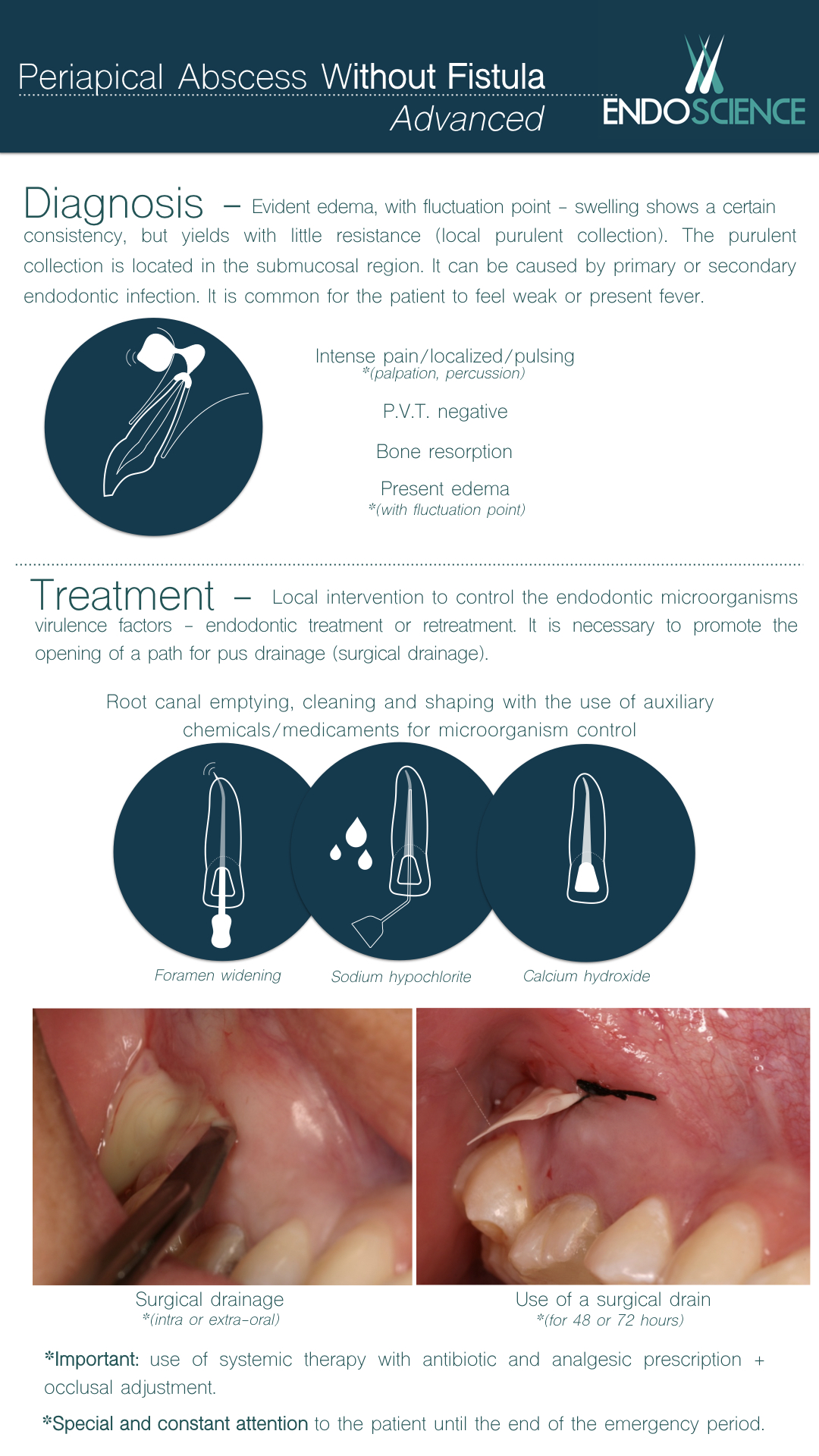 Periapical Abscess without Fistula – evolved | Endoscience