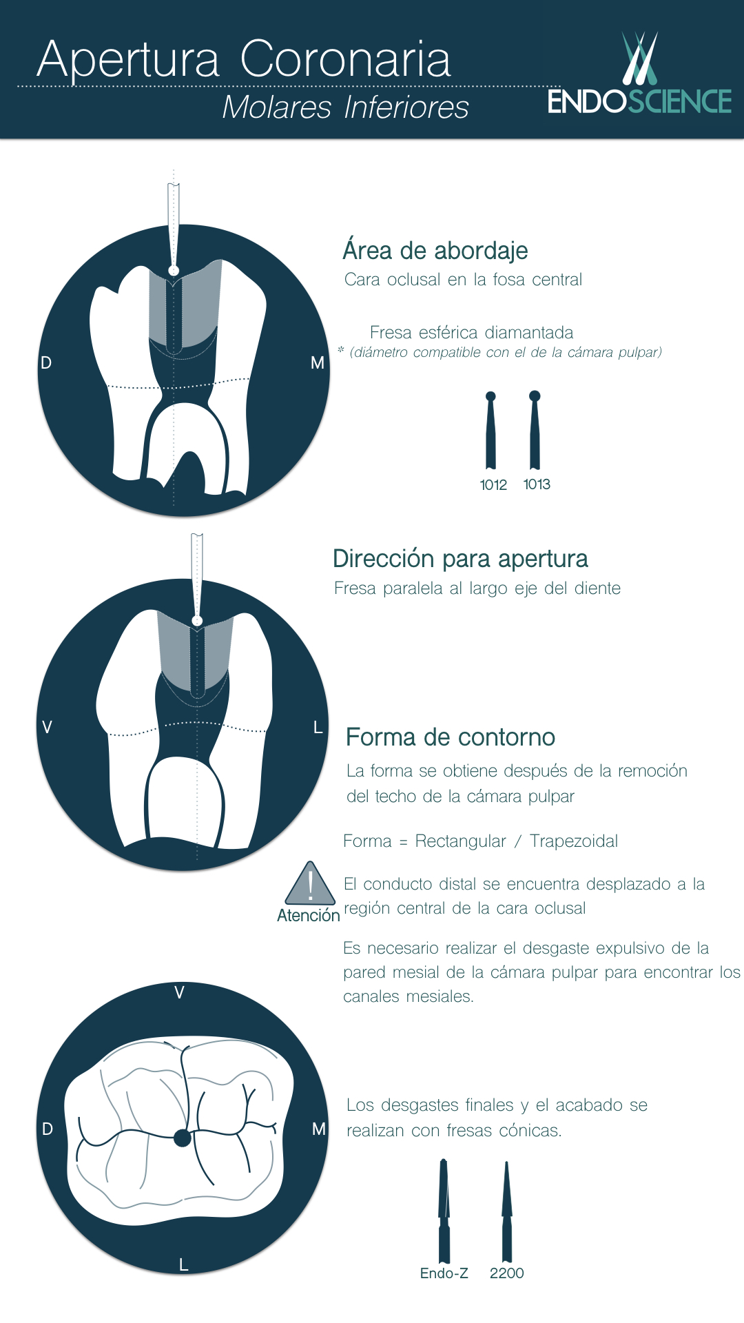 Apertura Coronaria de Molares Inferiores Endoscience